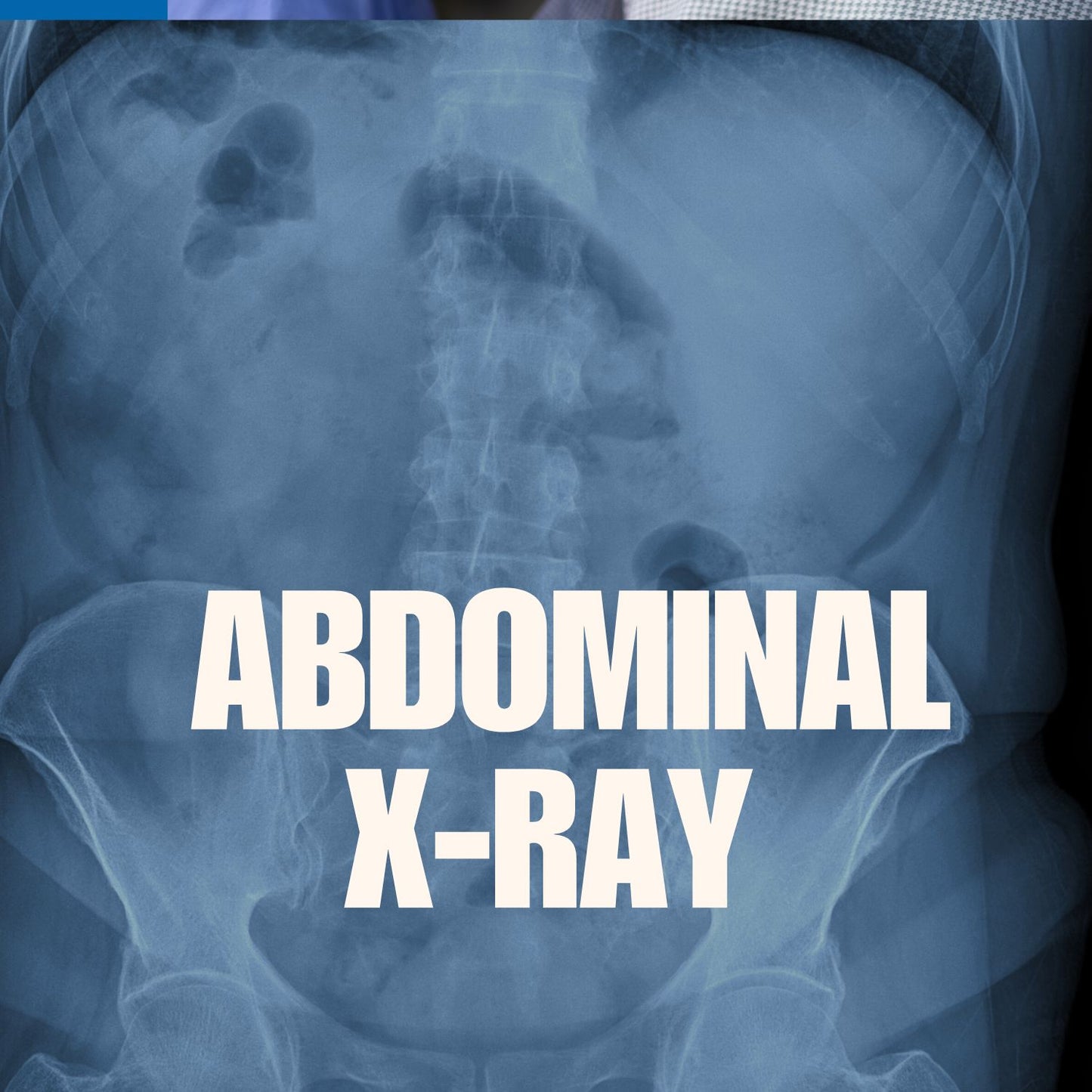 Abdominal X-rays mumtaz care