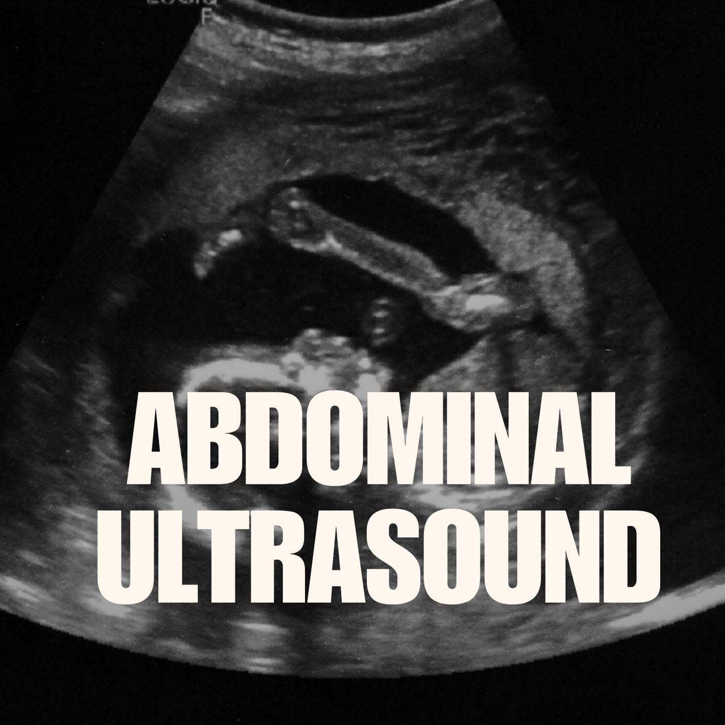 Abdominal ultrasound