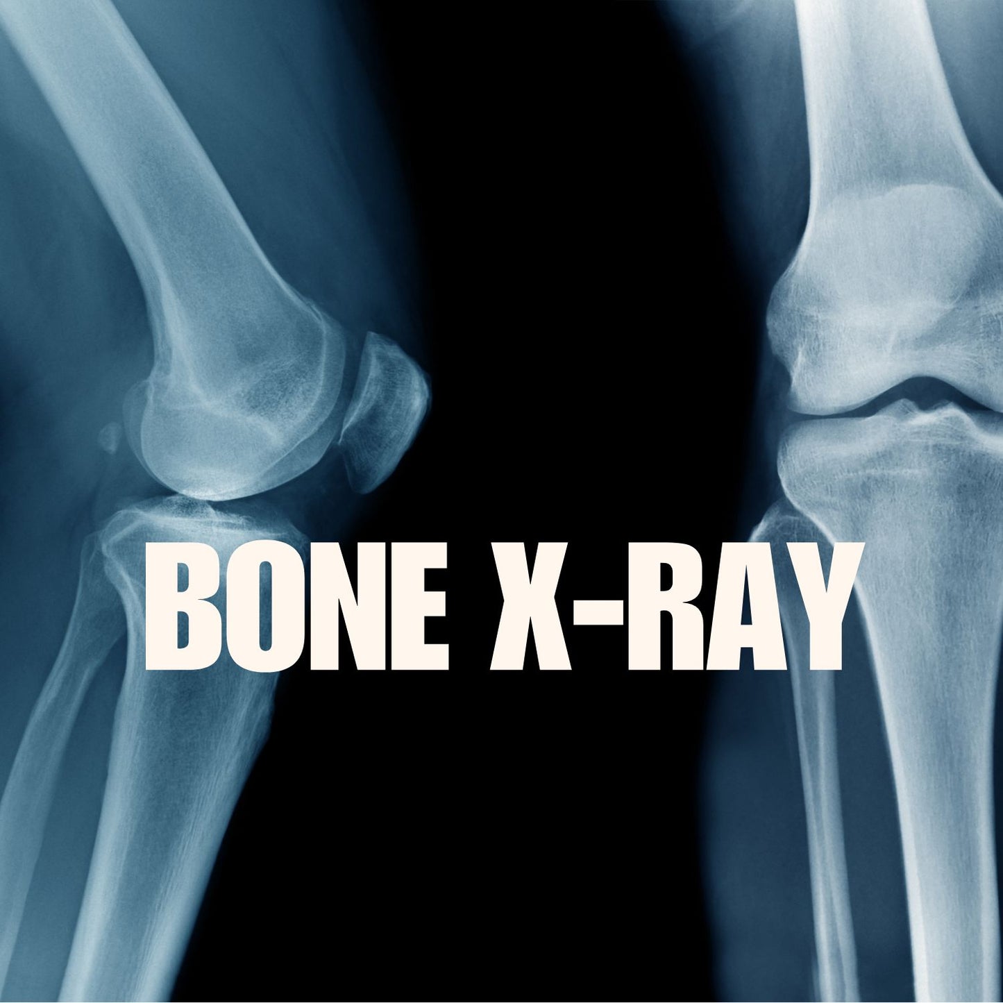Bone X-rays mumtaz care