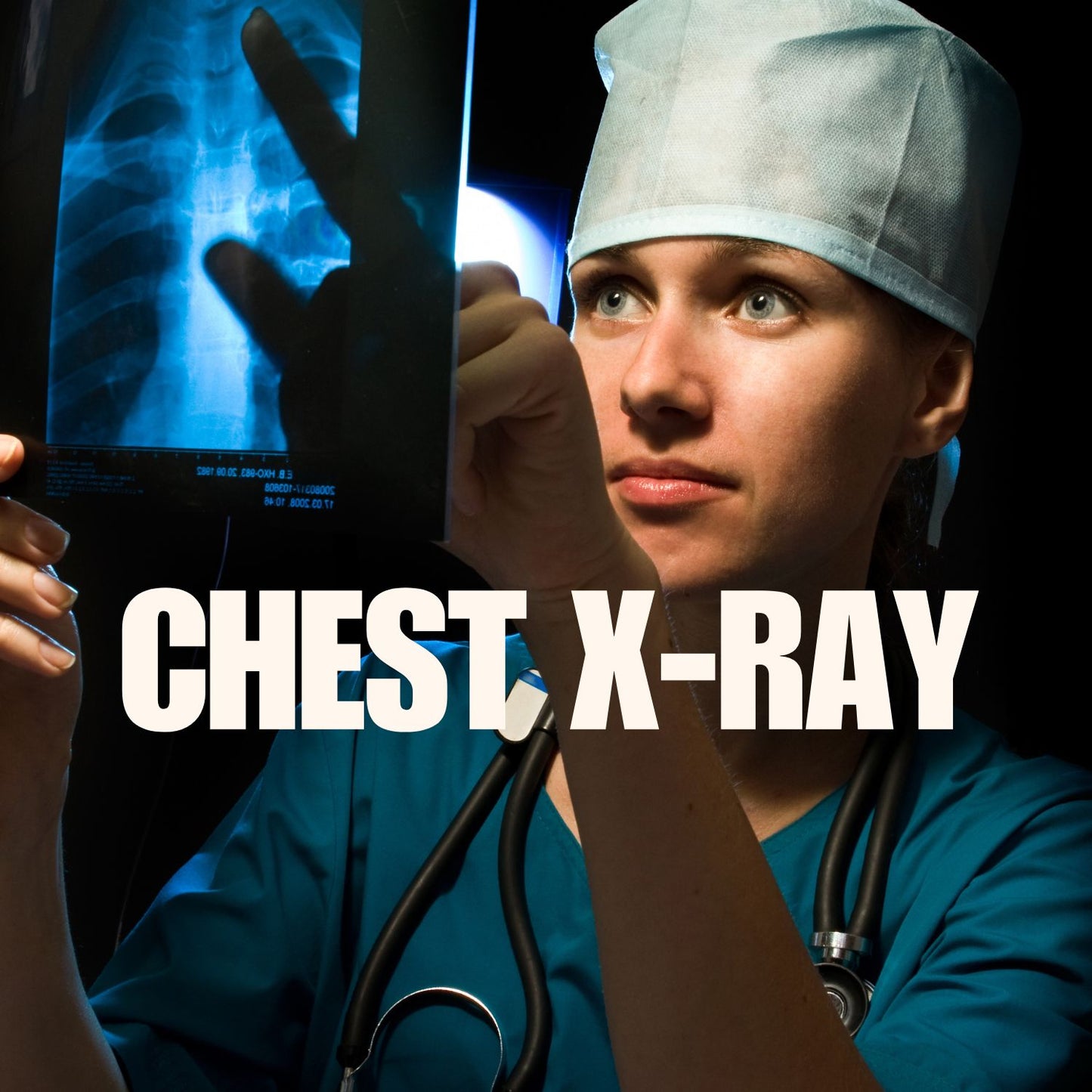 Chest X-rays mumtaz care