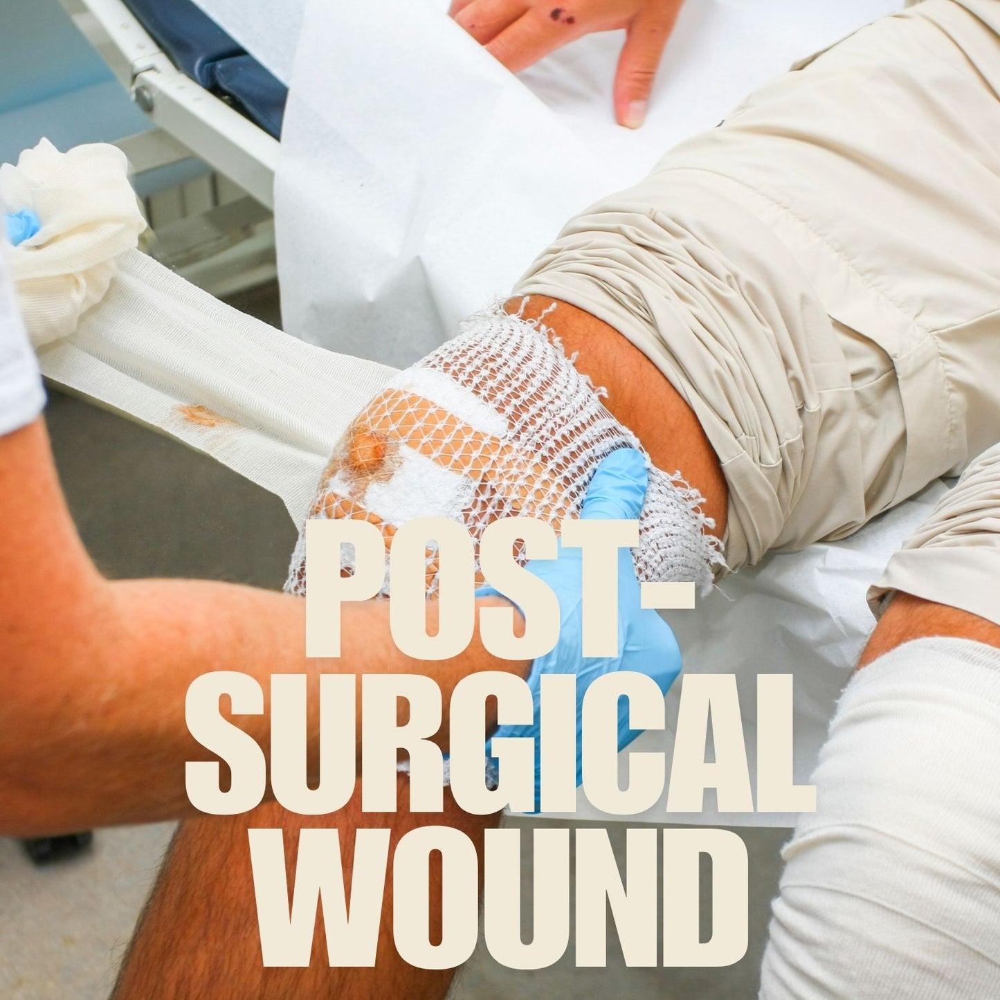 Post Surgical Wound mumtaz care
