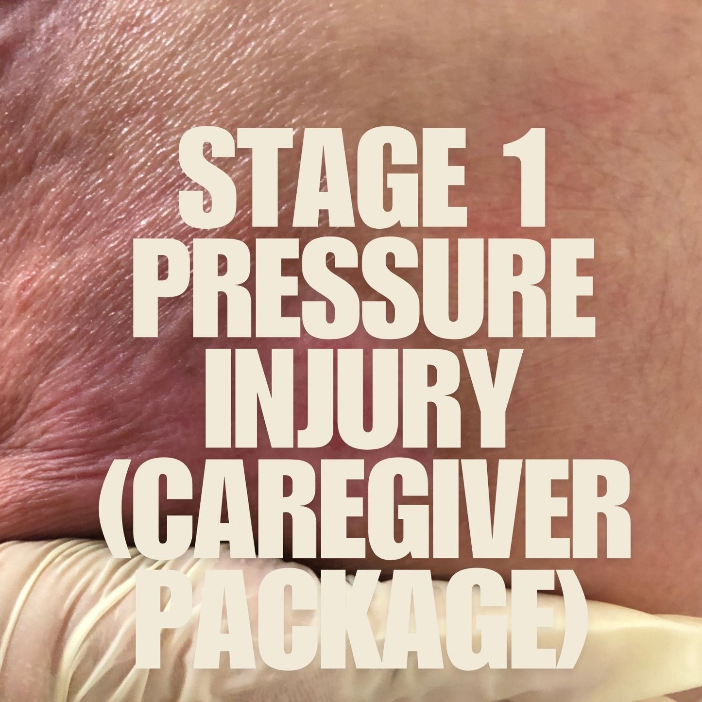 Pressure Ulcer-Stage 1 (Caregiver Package) mumtaz care