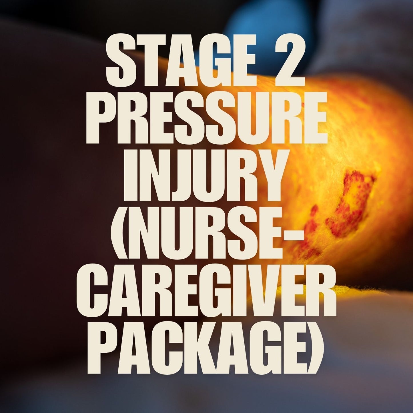 Pressure Ulcer-Stage 2 (Nurse-Caregiver Package) mumtaz care