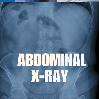 Abdominal X-rays mumtaz care
