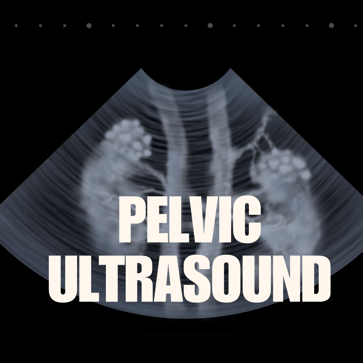 Pelvic ultrasound