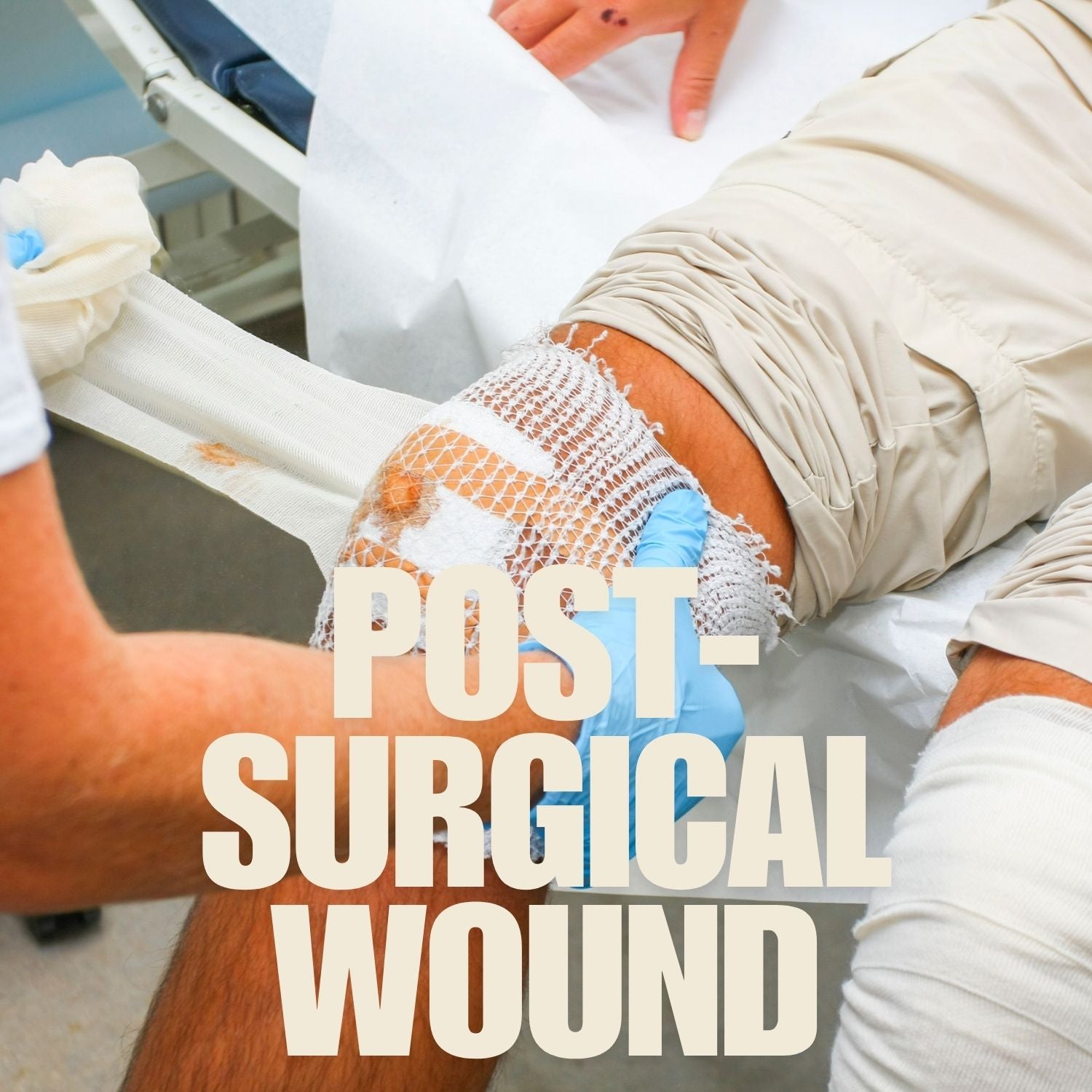 Post Surgical Wound mumtaz care